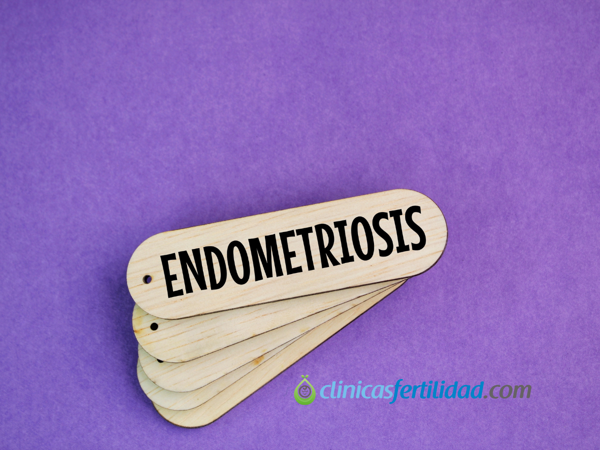 ¿Cuáles son los síntomas de la endometriosis?